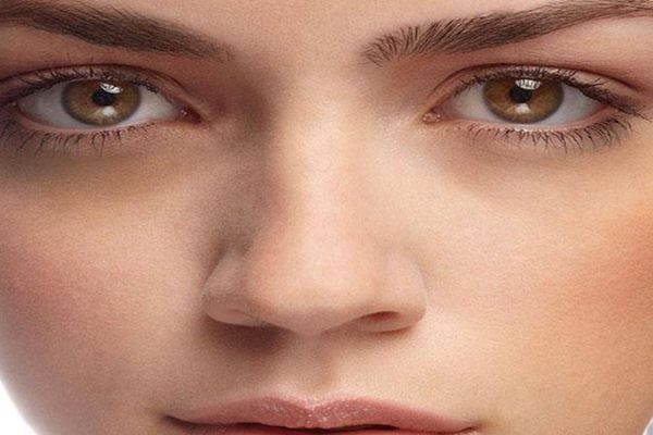 Dark Circles से कैसे छुटकारा पाए – Tips for Remove Dark Circle in Hindi Tips for Remove Dark Circle