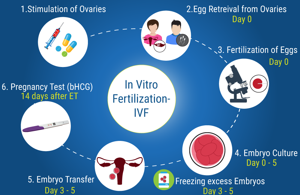 IVF treatment kyon kiya jaata hai
