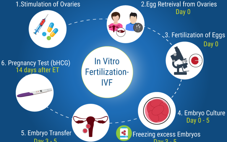 IVF treatment kyon kiya jaata hai