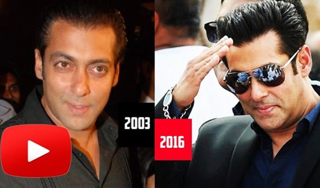 famous celebrity hair transplant