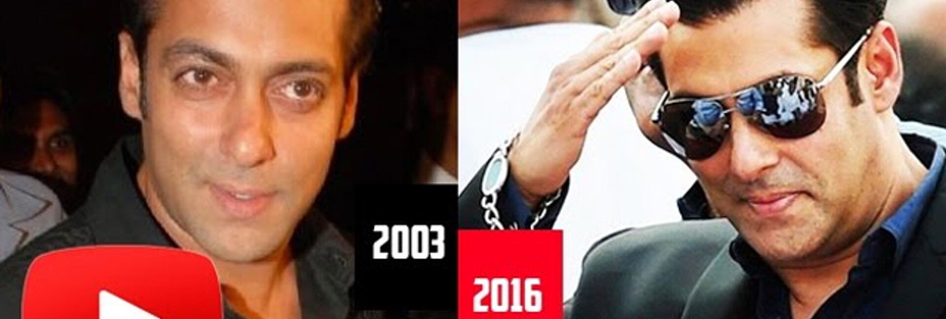 famous celebrity hair transplant