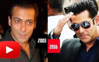 famous celebrity hair transplant