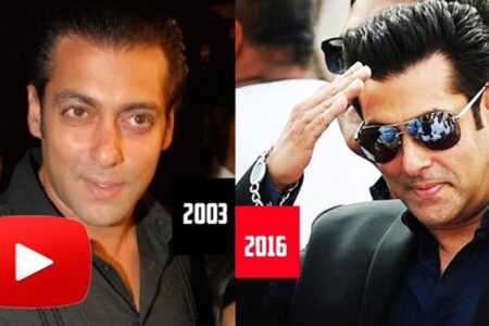 famous celebrity hair transplant