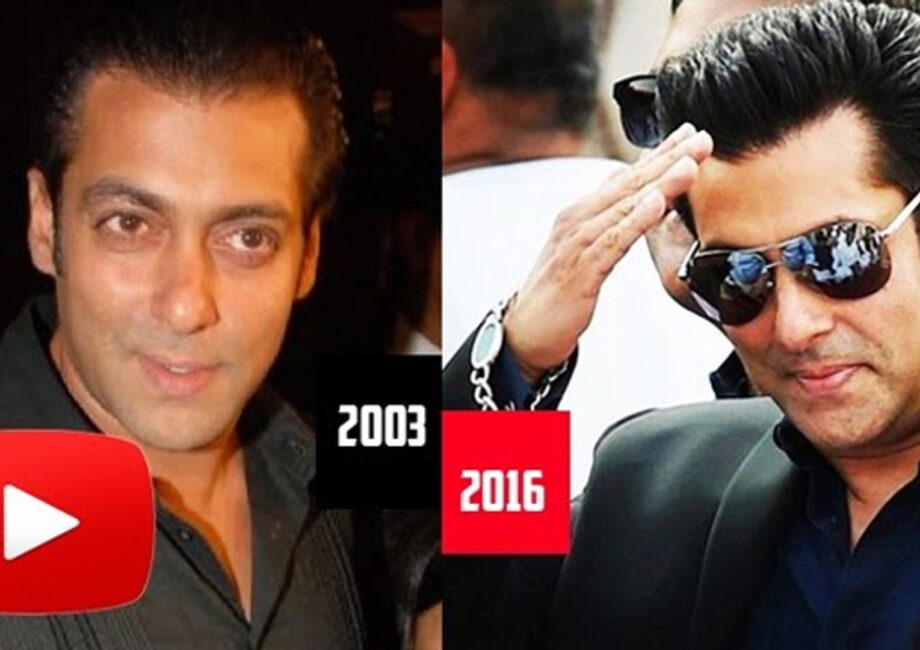 famous celebrity hair transplant