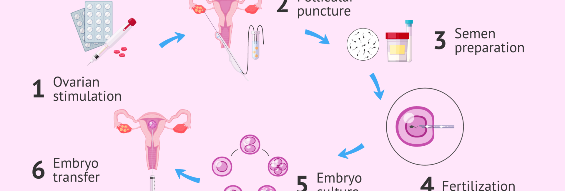 In vitro fertilization